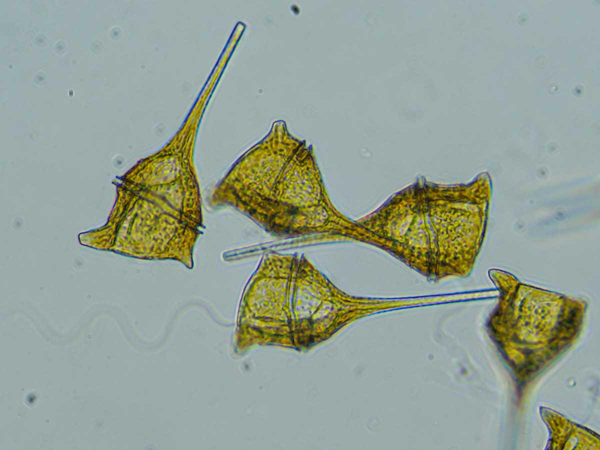 Photo of Ceratium divaricatum, credit to Bruce Foote, Feiro Marine Life Center